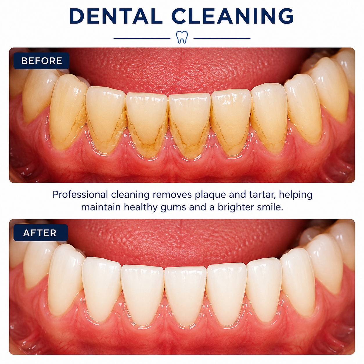 Dental cleaning before and after